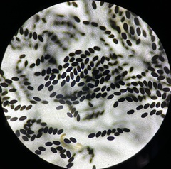 Hypocopra brefeldii