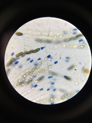 Rosellinia corticium