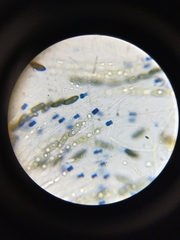 Rosellinia corticium