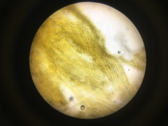 Trichoderma flavipes