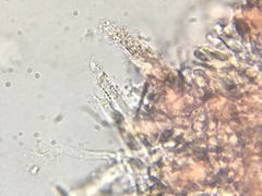 Rhizochaete radicata