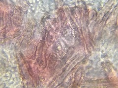 Rhizochaete radicata