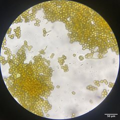 Oligonema schweinitzii