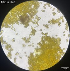 Oligonema schweinitzii