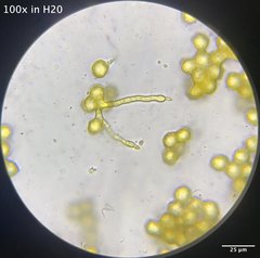 Oligonema schweinitzii