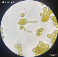 Oligonema schweinitzii