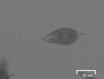 iNaturalist observation photo of euglenoids