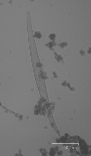 iNaturalist observation photo of Diatoms