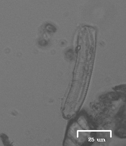 iNaturalist observation photo of Bacillariophyceae
