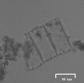 iNaturalist observation photo of Eunotia