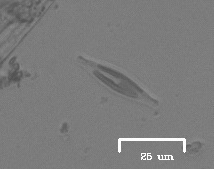 iNaturalist observation photo of Navicula