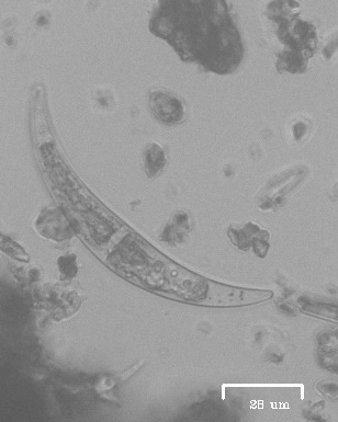 iNaturalist observation photo of Closterium