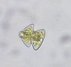 Staurastrum punctulatum