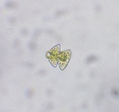 Staurastrum punctulatum