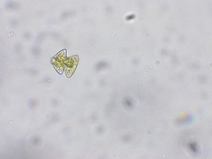 Staurastrum punctulatum