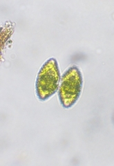 Staurastrum punctulatum