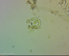 Ophiocytium