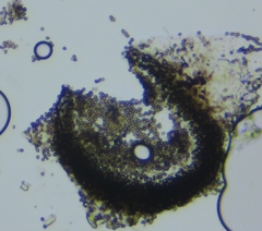Lichenoconium pyxidatae