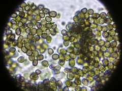 Lichenoconium pyxidatae