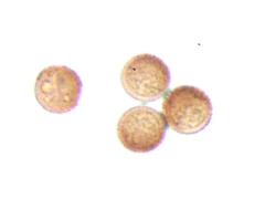 Lamproderma arcyrioides