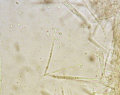 Lachnellula resinaria