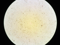 Lachnellula resinaria