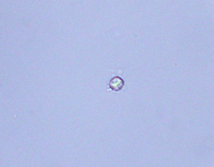 Golenkinia