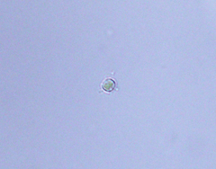 Golenkinia