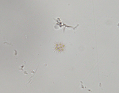 Pseudopediastrum boryanum longicorne