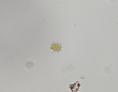 Pseudopediastrum boryanum longicorne