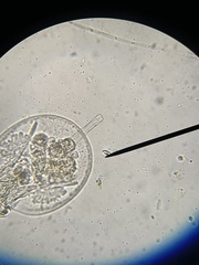 Testudinella