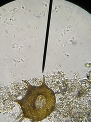 Centropyxis