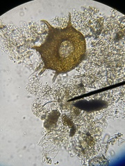 Centropyxis