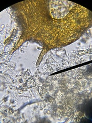 Centropyxis