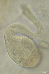 Litostomatea