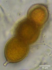 Pseudopediastrum integrum