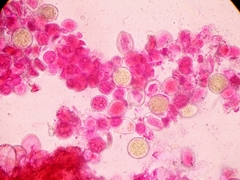 Melampsora galanthi-fragilis