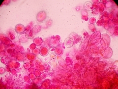 Melampsora galanthi-fragilis