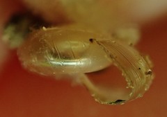 Glyphyalinia