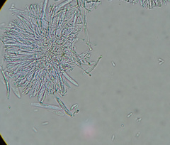 Pyrenopeziza