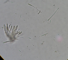 Lachnum brevipilosum