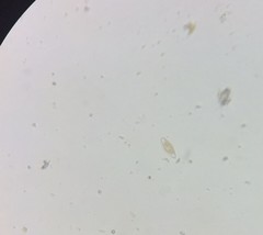 Cymbella