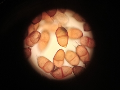 Puccinia rossiana