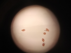 Puccinia rossiana