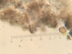 Lichenodiplis lecanoricola