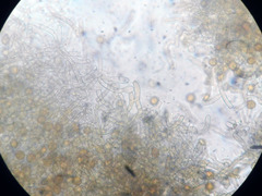 Botryobasidium simile