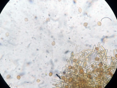 Botryobasidium simile