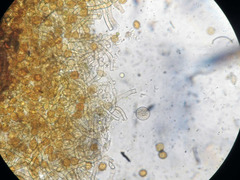 Botryobasidium simile