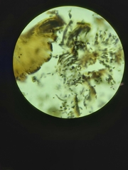 Phaeocalicium populneum