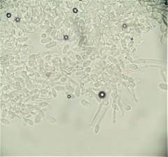 Hypomyces